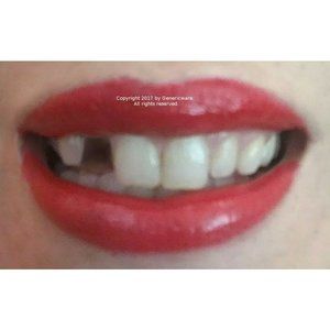 Genericware's Temporary Tooth Repair Kit